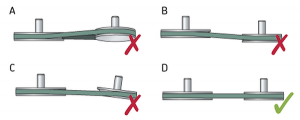 belt alignment horizontal